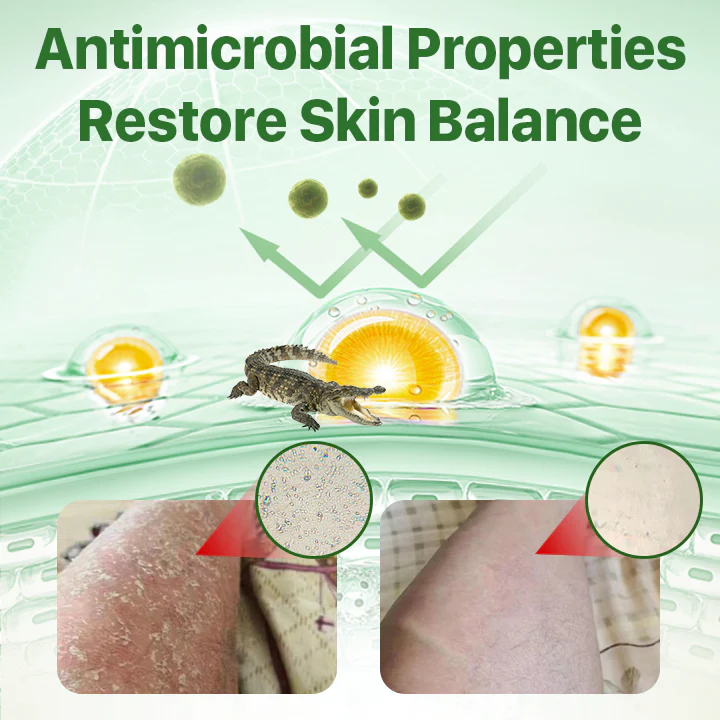 Fivfivgo™ Psoriasis Relief Crocodile Oil Soap