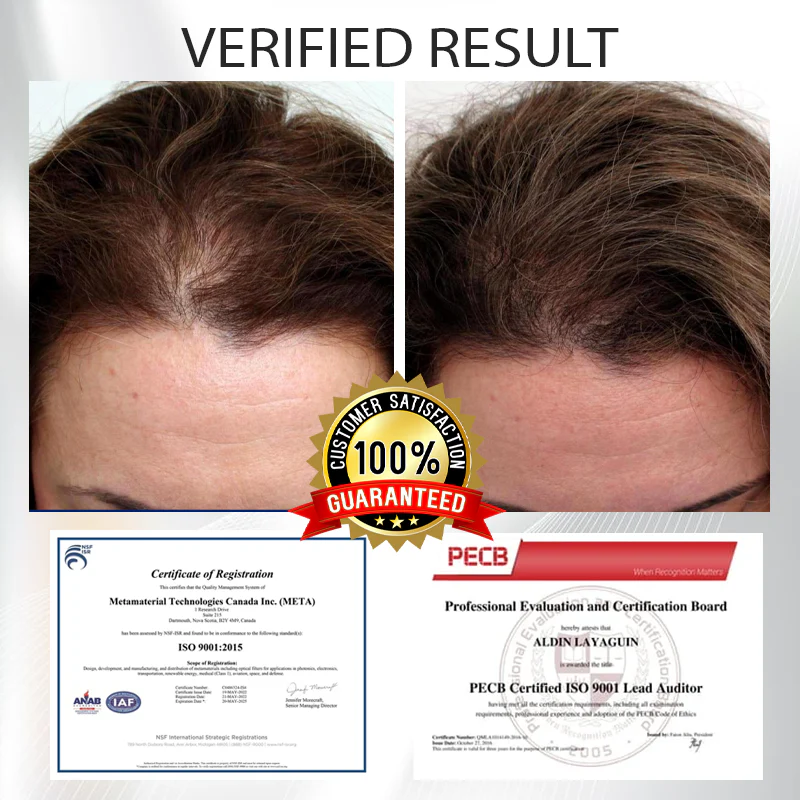 Fivfivgo™ Alopecia Recovery Hair Booster Roll-On