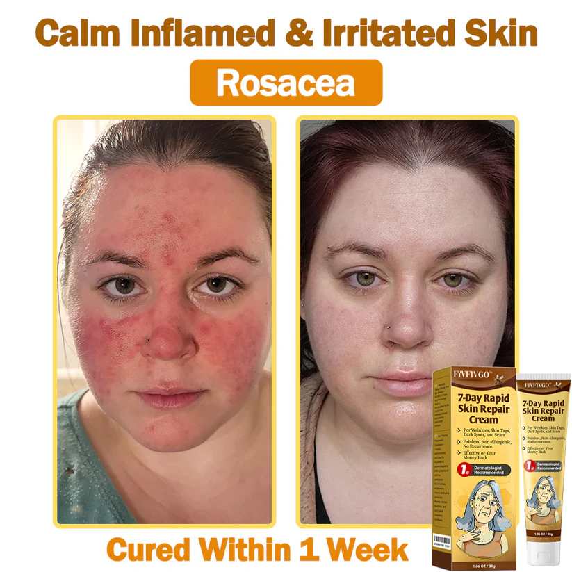Fivfivgo™ 7-Day Rapid Skin Repaur Cream