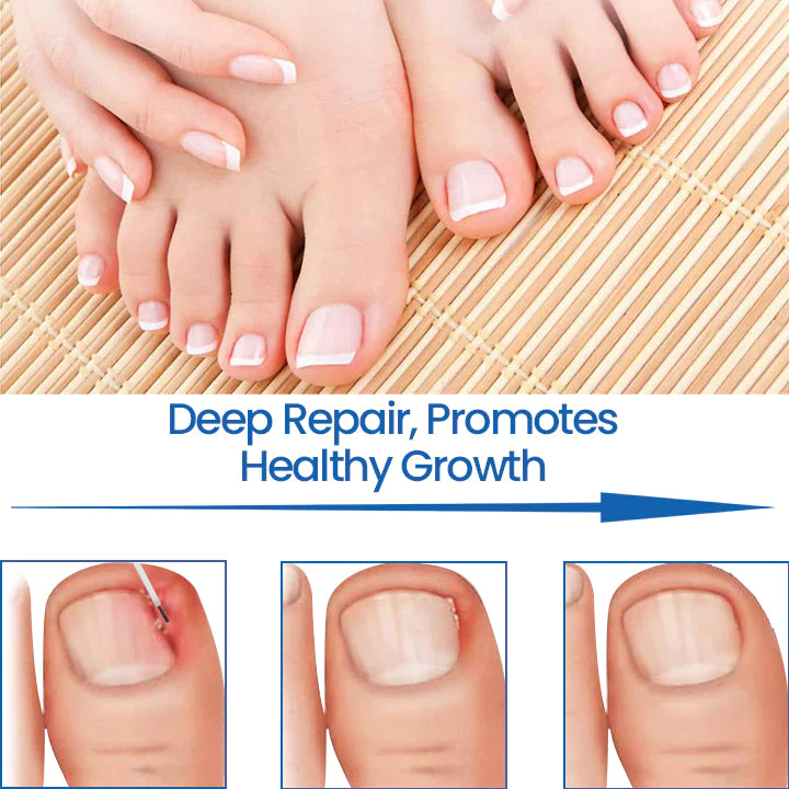 Fivfivgo™ NailHeal pflanzliches Nagelreparaturgel