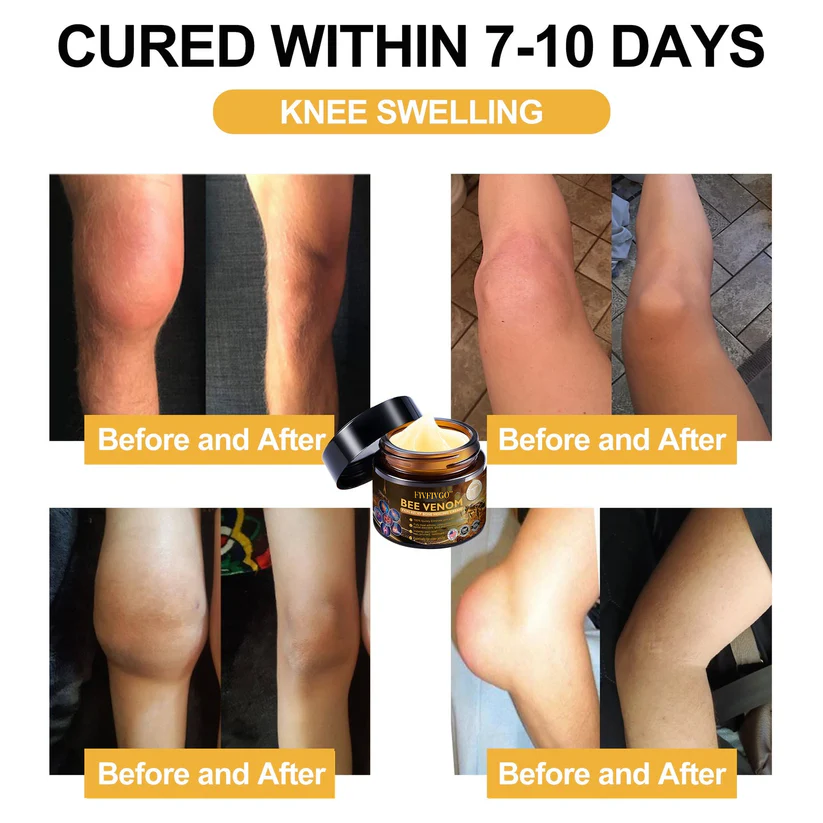 Fivfivgo™ Bee Venom Arthritis Therapy Cream (Specially for older adults & AAOS recommends)