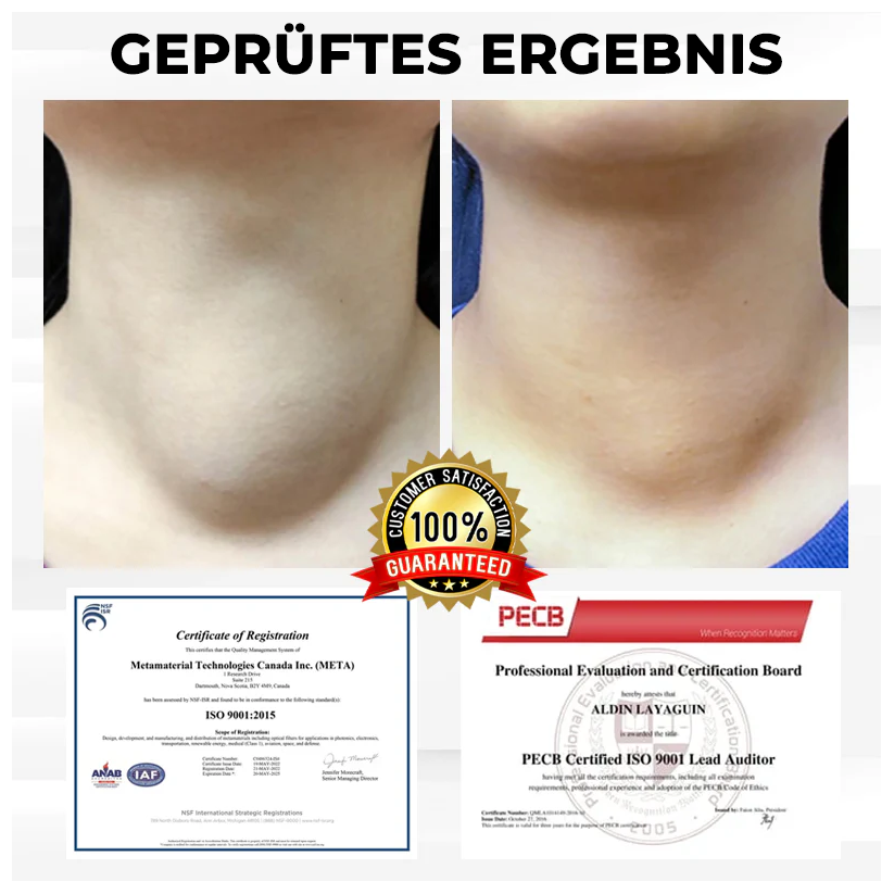 Fivfivgo® VenoHerb Schwarzkümmel-Ödemlöser-Balsam