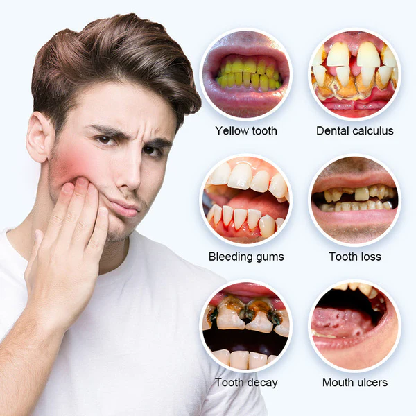 Fivfivgo™ Blanchiment des dents Repair Regrowth Dental Gel