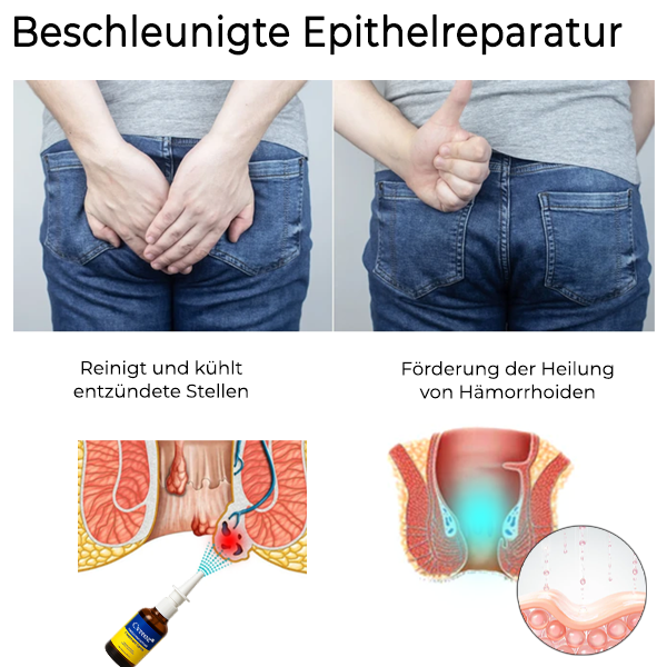 Cvreoz® Pflanzliche Hämorrhoiden Behandlung Anal Spray