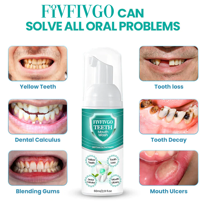 Fivfivgo™ Teeth Herbal Mouthwash – Lösen Sie alle Mundprobleme