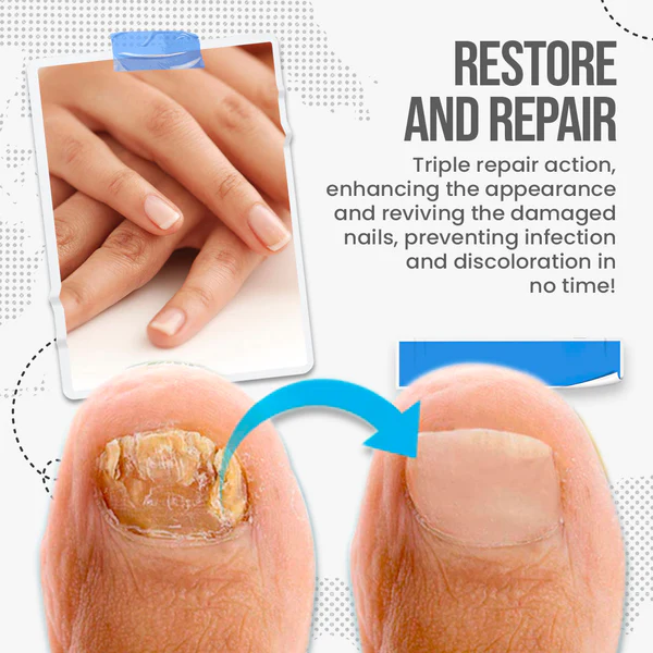 Fivfivgo™ FungusShield Nail Fungus Treatment Cream