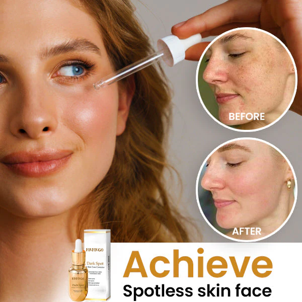 Fivfivgo™ Dark Spot and Skin Tone Corrector