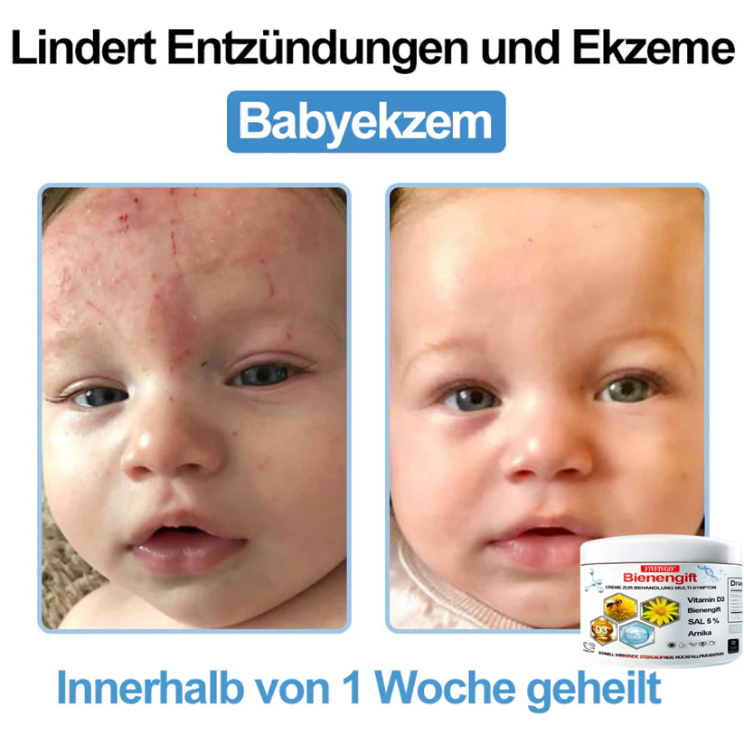 Fivfivgo™ Bienengift Creme Zur Behandlung Multi-symptom