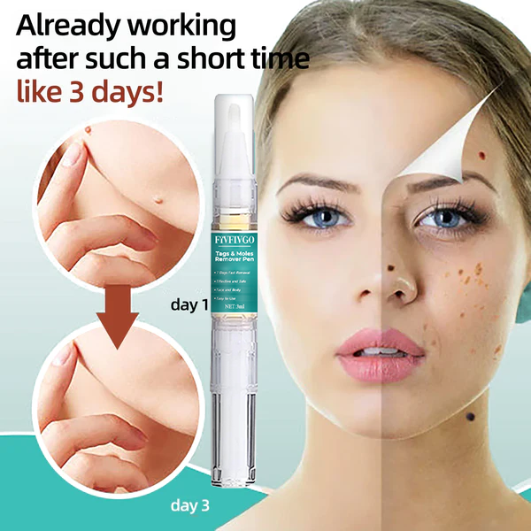 Fivfivgo™ Tags & Muttermale Entferner Stift