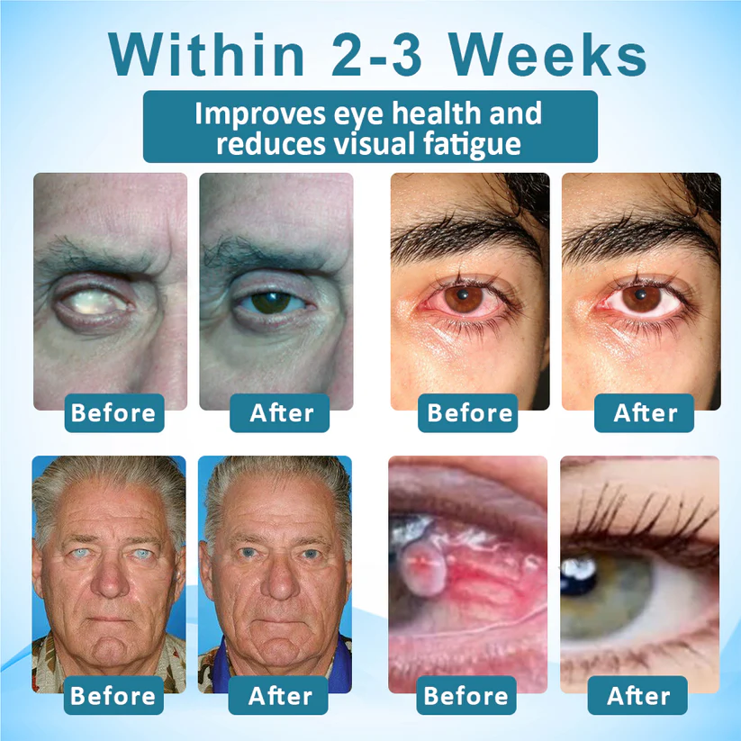 Fivfivgo™ Clarity Care Advanced Eye Drops