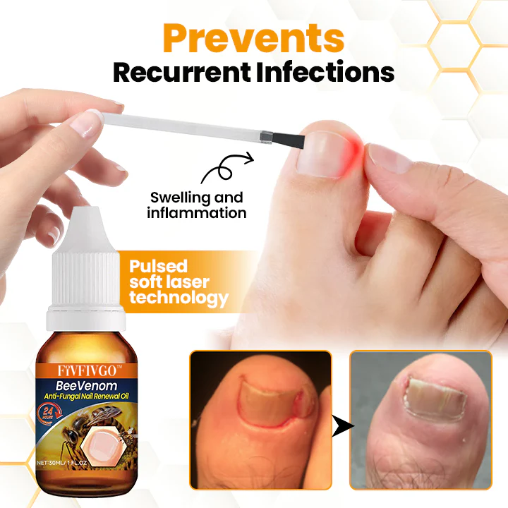 Fivfivgo™ BeeVenom Anti-Fungal Nail Renewal Oil