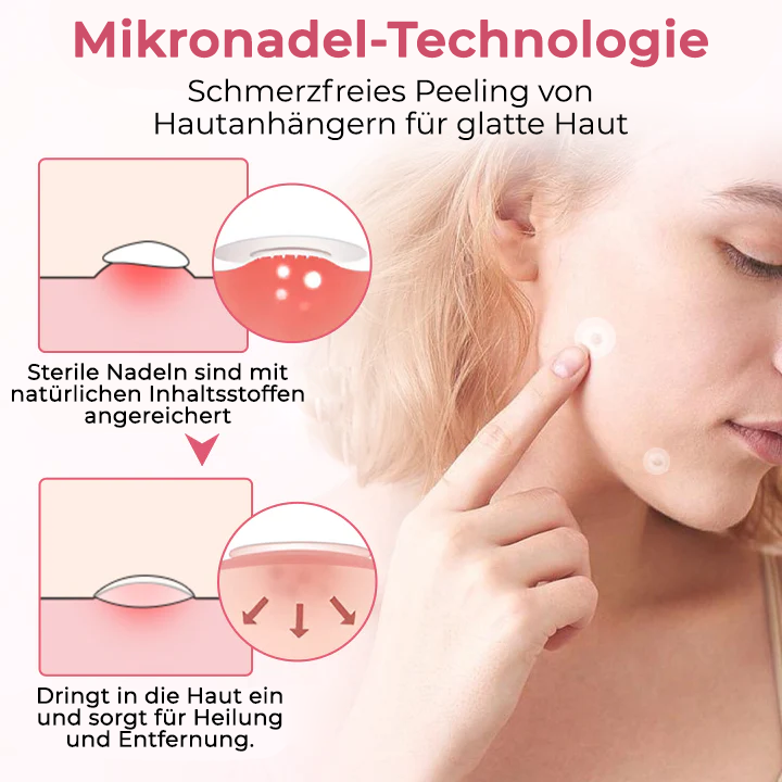 Fivfivgo® Schmerzfreies Mikro-Warzenentfernungspflaster