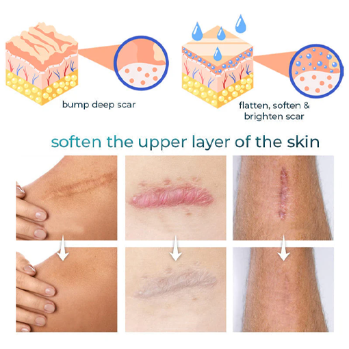 Fivfivgo™ Advanced Scar Removal Gel