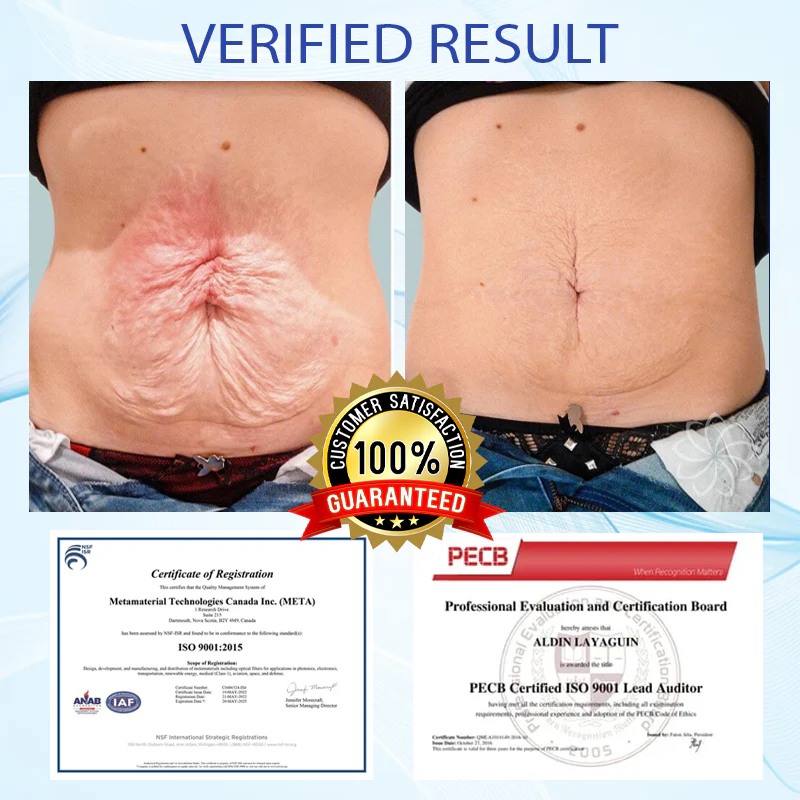 Fivfivgo™ Deep Elastic SkinRenew HA Cream