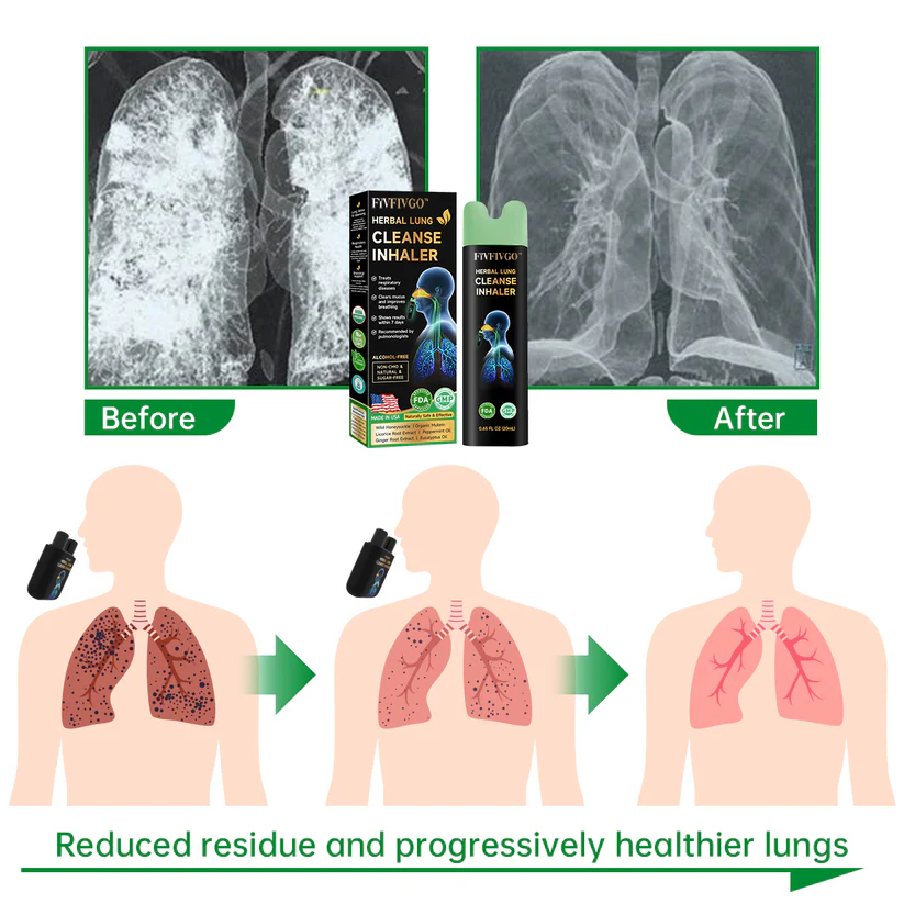 Fivfivgo™ Lung Mucus Cleansing Inhaler (Recommended by Top Lung Specialists)