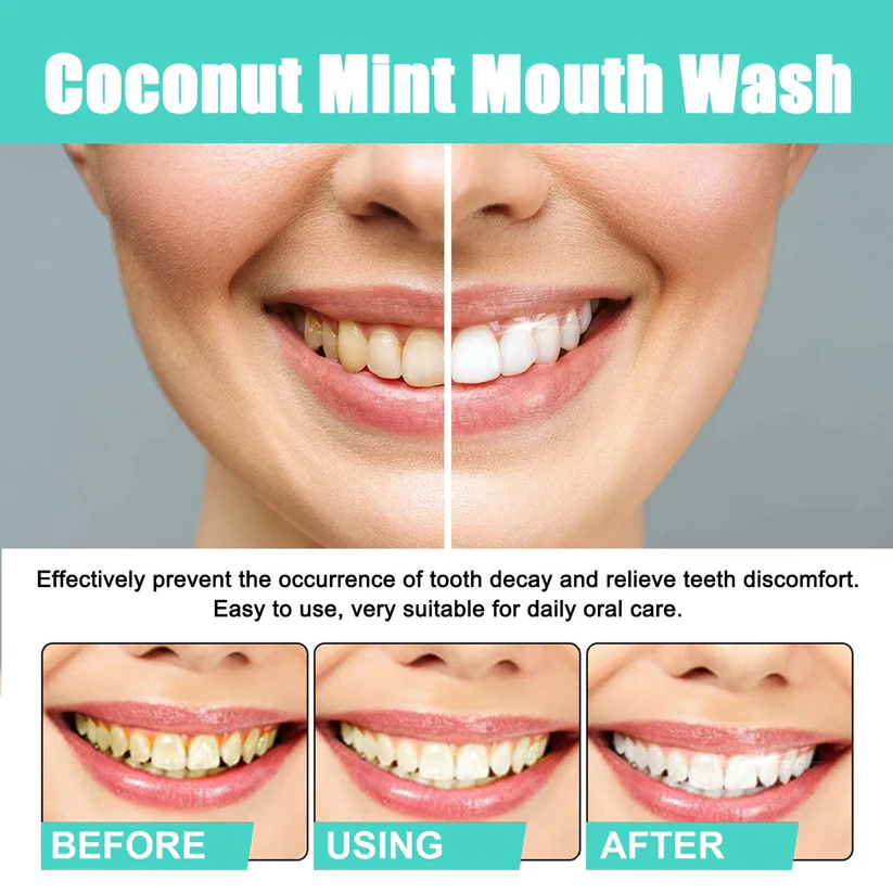 Fivfivgo™ Cocomint Pulling Oil with 7 Essential Oils & Vitamins