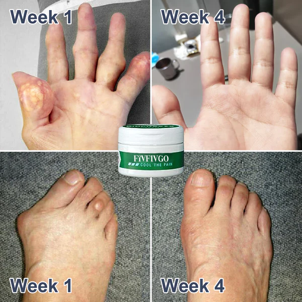 Fivfivgo™ PRO Bee Venom Pain and Bone Healing Cream