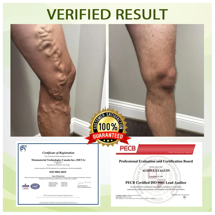 Fivfivgo™ SwellSoothe Lymphatische Creme