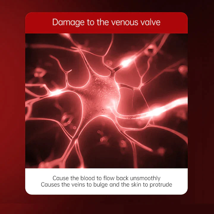 Fivfivgo™ Crème anti-varices