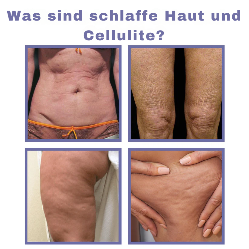 Fivfivgo® Schlankheitskur Unsichtbarer Beinlift