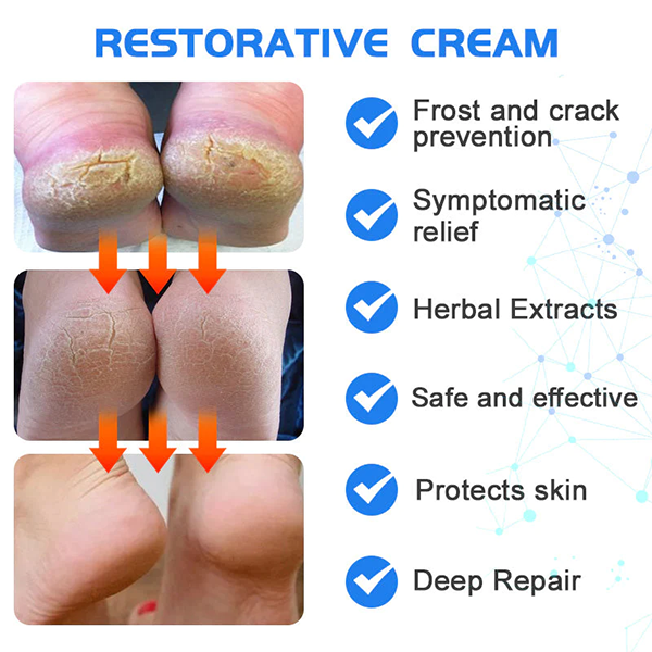 Fivfivgo™ Crème réparatrice intense pour talons crevassés