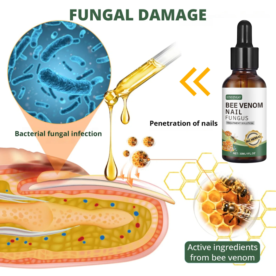 Fivfivgo® Bee Venom Nail Fungus Treatment Solution: Natural Formula for Toenail & Fingernail Health