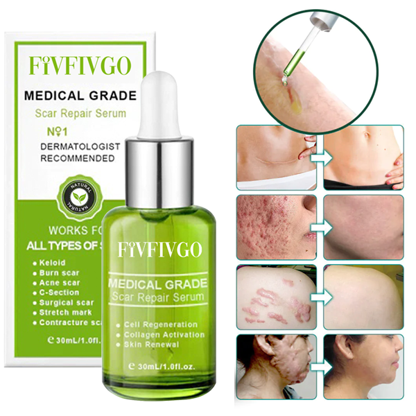 Fivfivgo™ Advanced Scar Repair Serum für alle Arten von Narben – insbesondere Aknenarben, Operationsnarben und Dehnungsstreifen