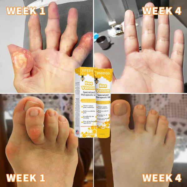 Fivfivgo™ Bienengift-Gel zur Schmerzlinderung