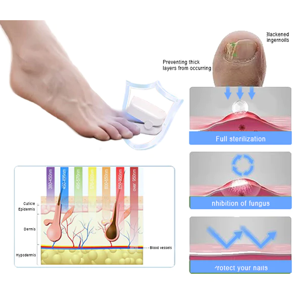 Fivfivgo™ Appareil révolutionnaire de luminothérapie à haute efficacité pour les maladies des ongles des pieds