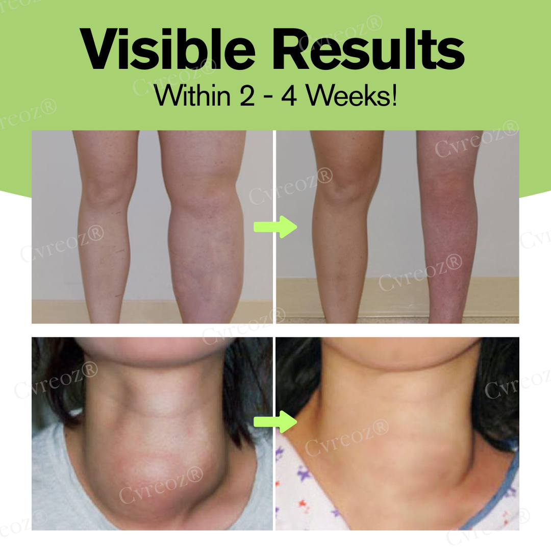 Fivfivgo® Herbal Lymphatic Detox Cream