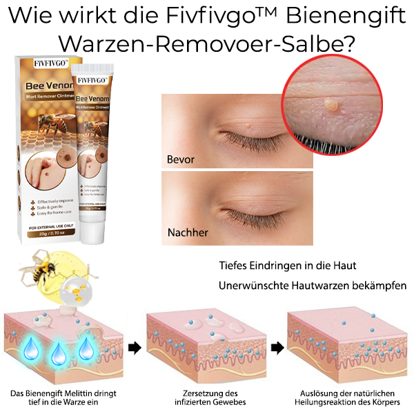 Fivfivgo™ Bienengift-Warzenentferner-Salbe