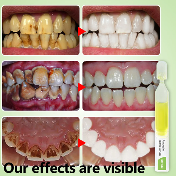 Fivfivgo™ Ampullihammasseerumi