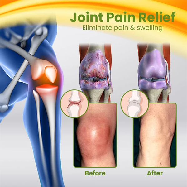 Fivfivgo™ BEETox Joint & Bone Therapy Cream