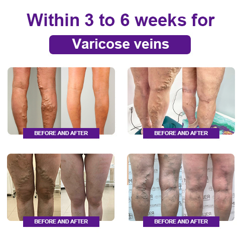 Fivfivgo™ Beinwell Bio Kräutersalbe