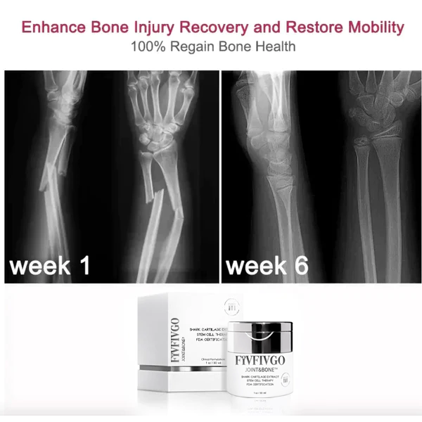 Fivfivgo™ Joint&Bone Haifischknorpel-Stammzellencreme