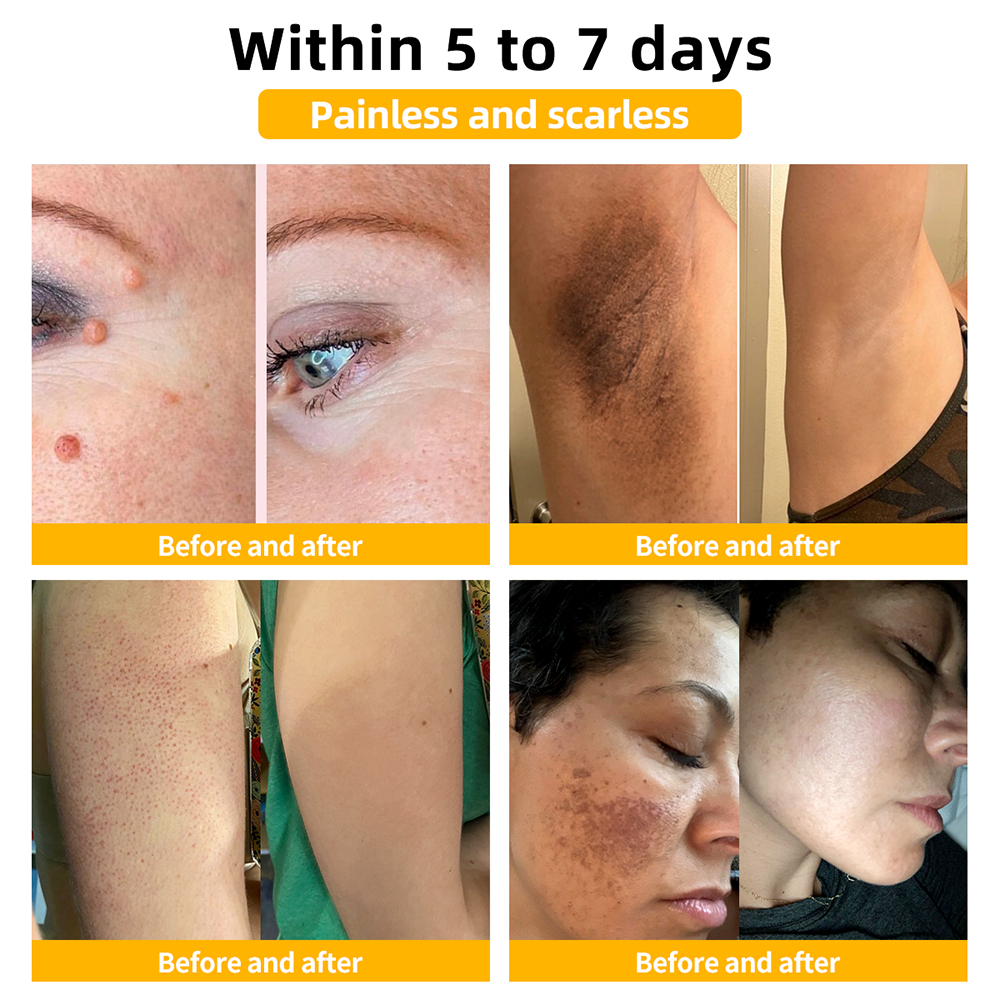 Fivfivgo™ Bee Poison Skin Treatment Cream