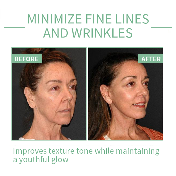 Fivfivgo™ Sérum Visage au Botox Anti-âge Advanced Collagen Boost pendant 30 Jours