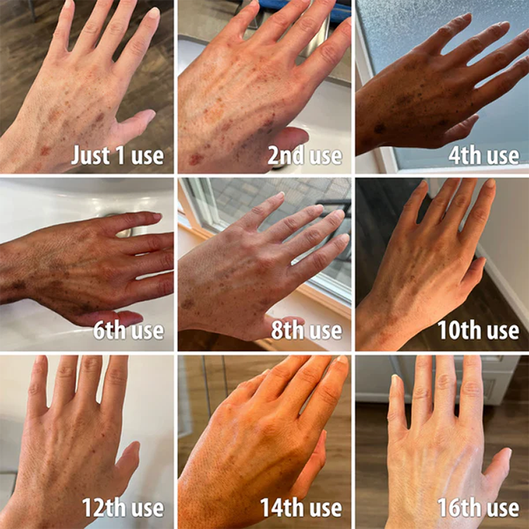 Fivfivgo™ Bienengift-Antimykotika-Creme