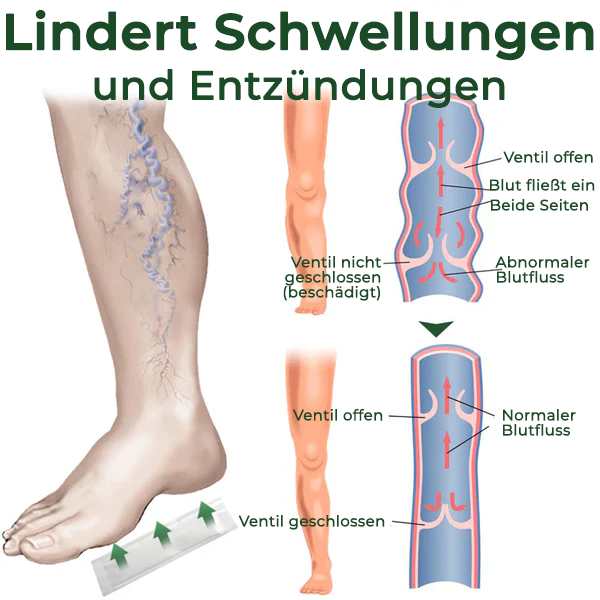 Cvreoz® Kräuter-Fußpflaster zur Linderung von Krampfadern