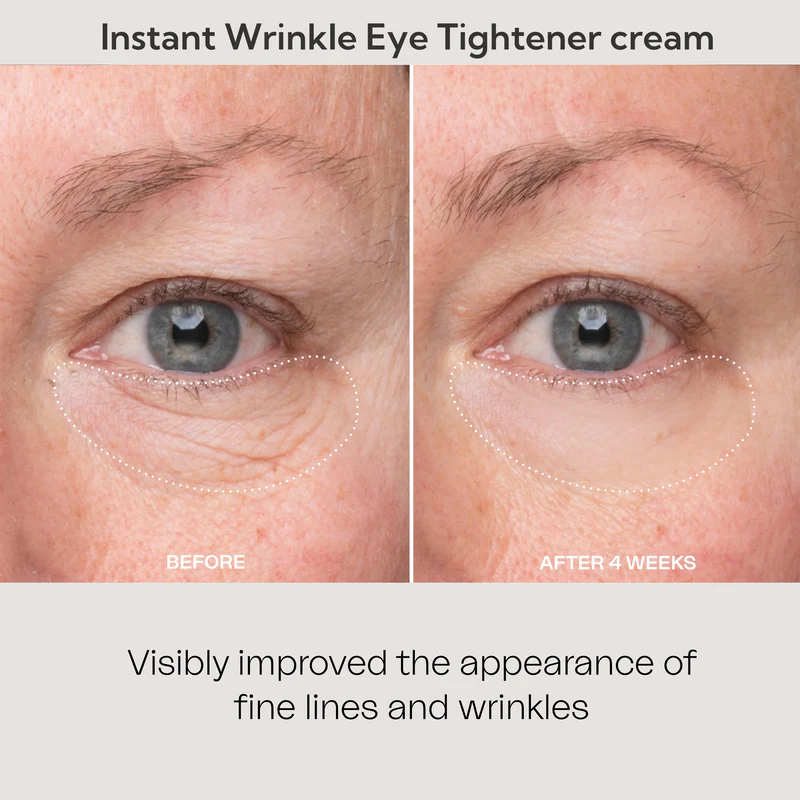 Fivfivgo™ Instant Eye Wrinkle Tightening Cream