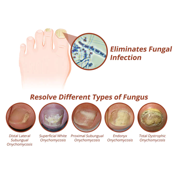 Fivfivgo™ Intense Nail Growth and Strengthening Serum