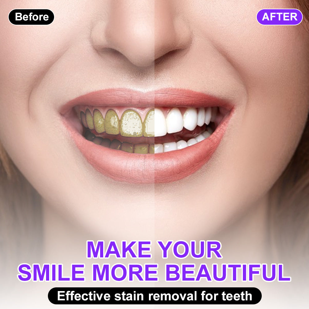 Fivfivgo® Colour Corrector Serum | Clinically proven to gently remove stains, whiten teeth, and restore natural brightness in just 3 days — safe for sensitive teeth and enamel