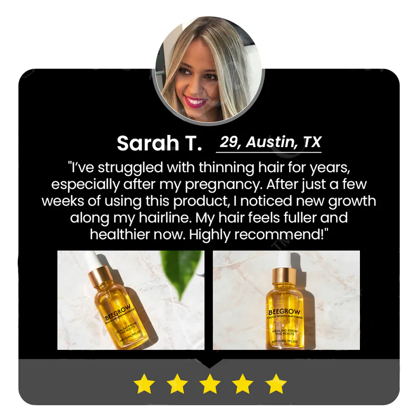 ✅Offizieller Shop: Fivfivgo™ BeeGrow Follicle Reviving Hair Essence 🌿 Anerkannt von AHLA & USP (klinisch erwiesen, um Haarfollikel zu aktivieren, die Gesundheit der Kopfhaut zu verbessern, Entzündungen zu reduzieren und Haarausfall zu verhindern)