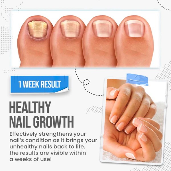 Fivfivgo™ FungusShield Nail Fungus Treatment Cream