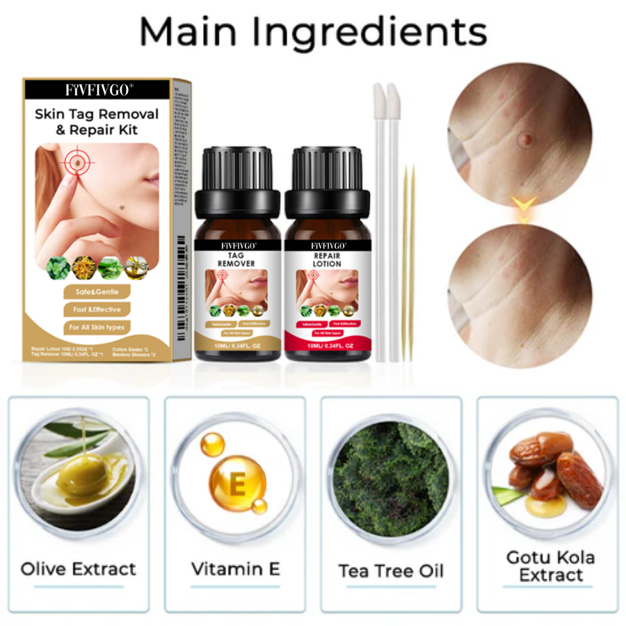 Fivfivgo® Skin Tag Removal & Repair Kit