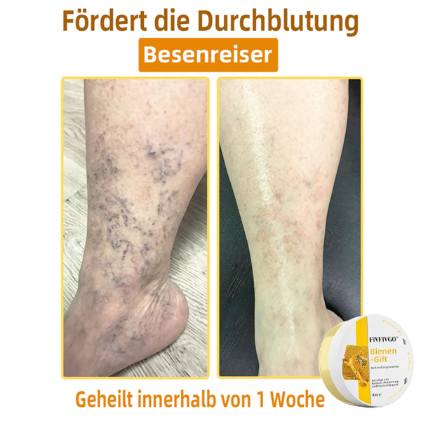 Fivfivgo™ Bienengift-Therapie-Creme
