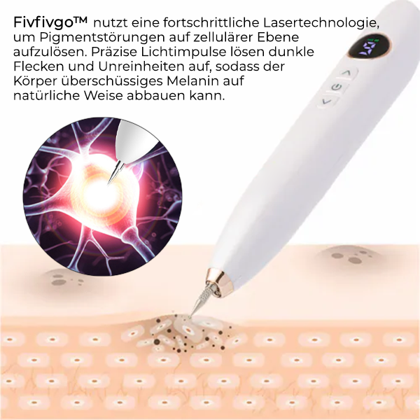 Fivfivgo™ Laser-Punkt-Entfernungsstift