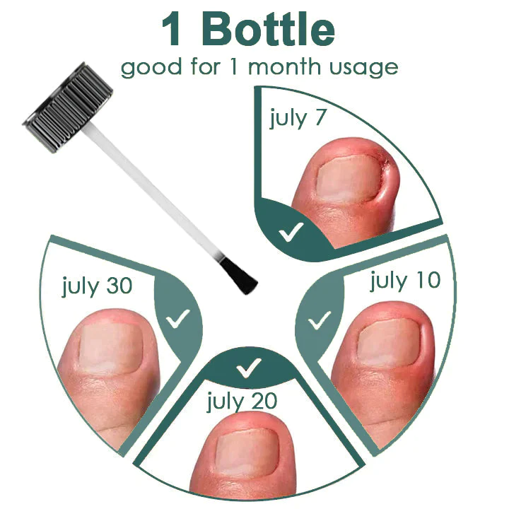 Fivfivgo™ Gel zur Behandlung von Nagelpilz