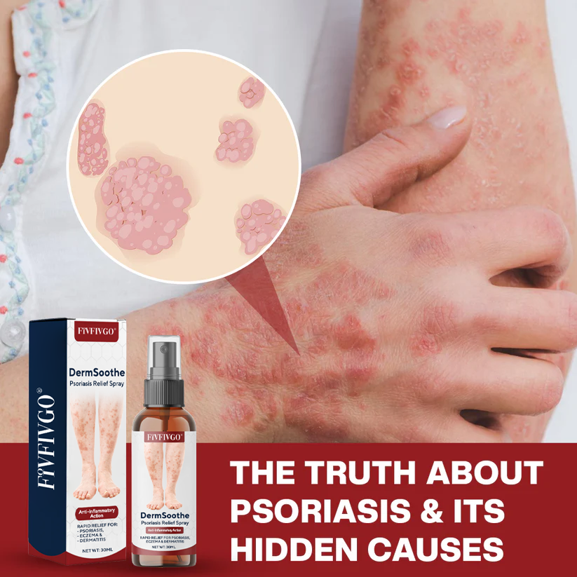 Fivfivgo® DermSoothe Psoriasis Relief Spray