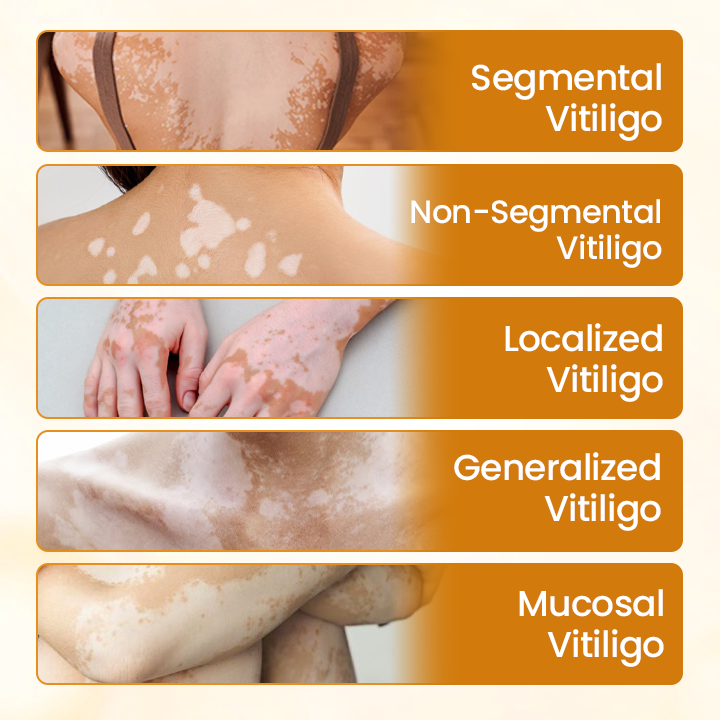 Fivfivgo® VitiCalm Bee Venom Cream